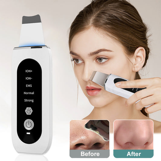 Ultrasonic Blackhead Remover and Face Scrubber - Deep Cleansing and Exfoliation