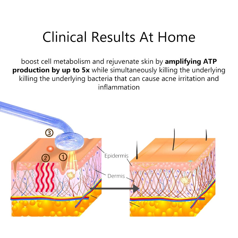 ThermaGlow: High Frequency Clinical Skin Therapy Wands with Fusion Neon + Argon Light Therapy